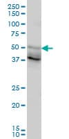 PathPlus™ FOXA2 Antibody (clone 1C7)