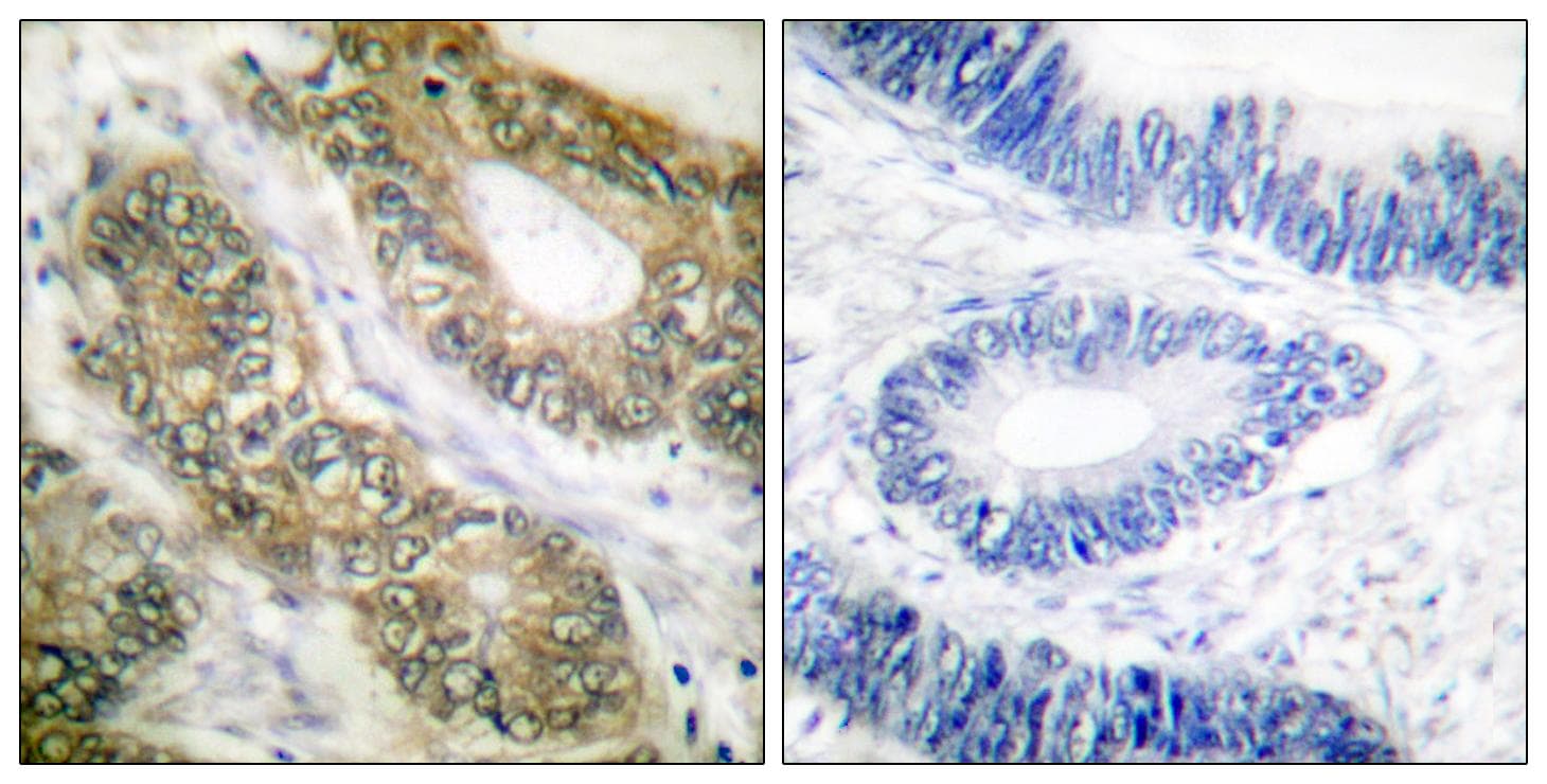 ESPL1 / Separase Antibody (p801)