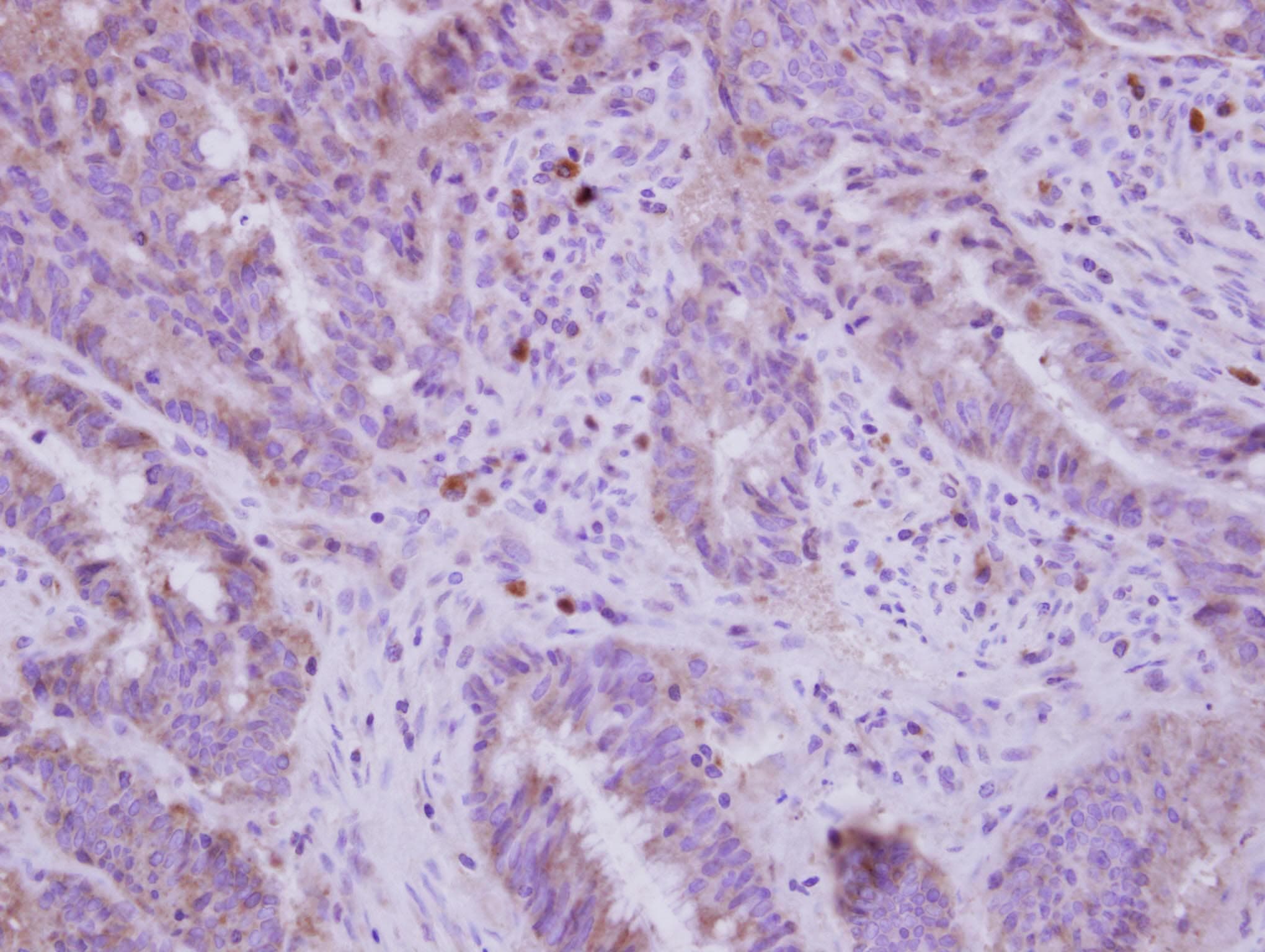 FADS1 Antibody