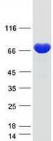 Human ANXA6/Annexin A6/Annexin VI Protein (Recombinant Myc-DDK (Flag))