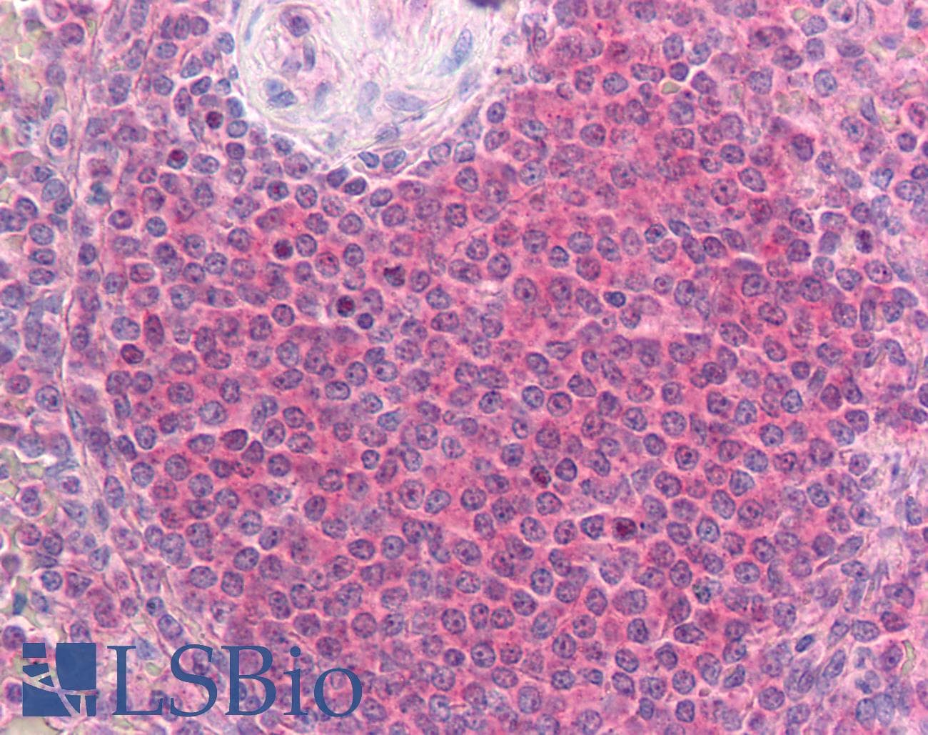 IHC-plus™ PRKCA / PKC-Alpha Antibody (phospho-Thr497)