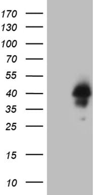 HOXD4 Antibody (clone OTI4E7)