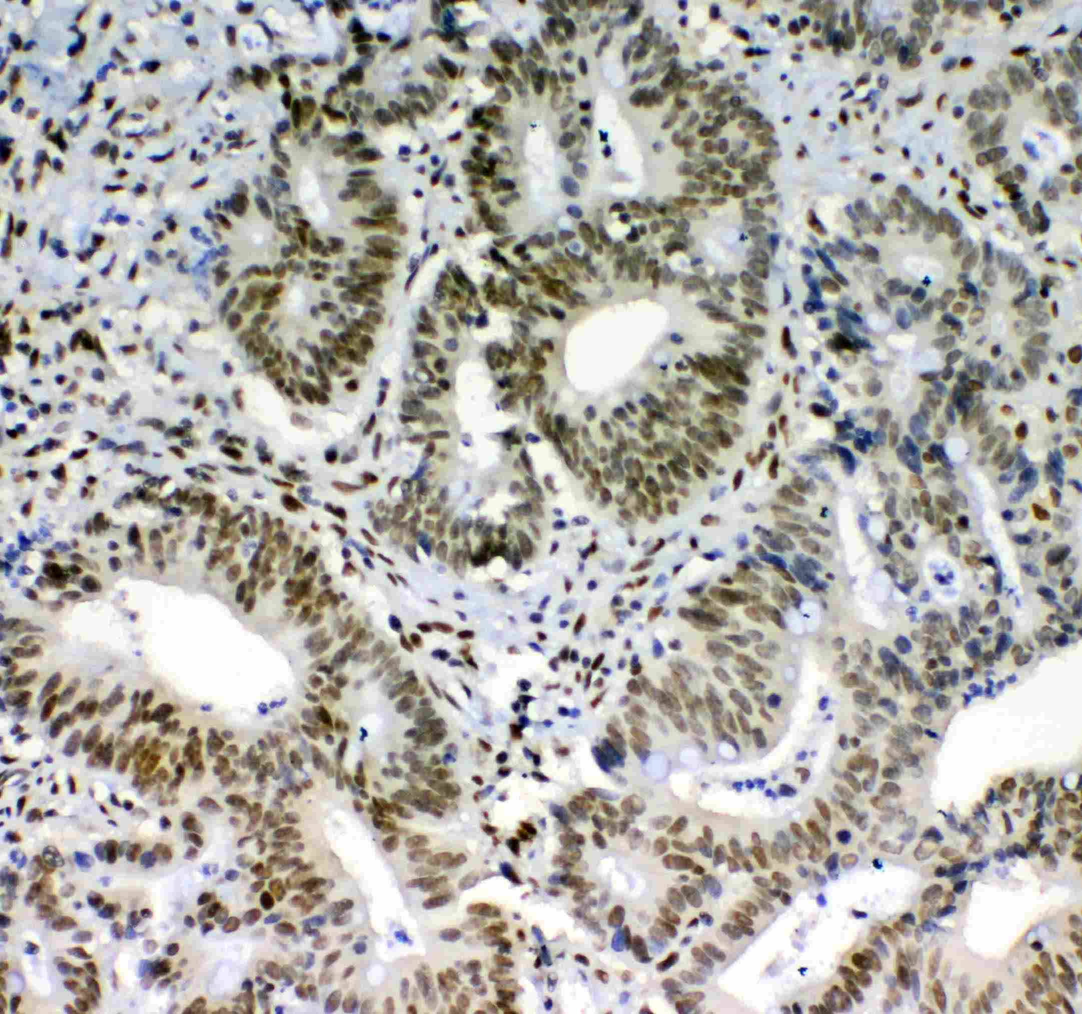 BLIMP1 / PRDM1 Antibody