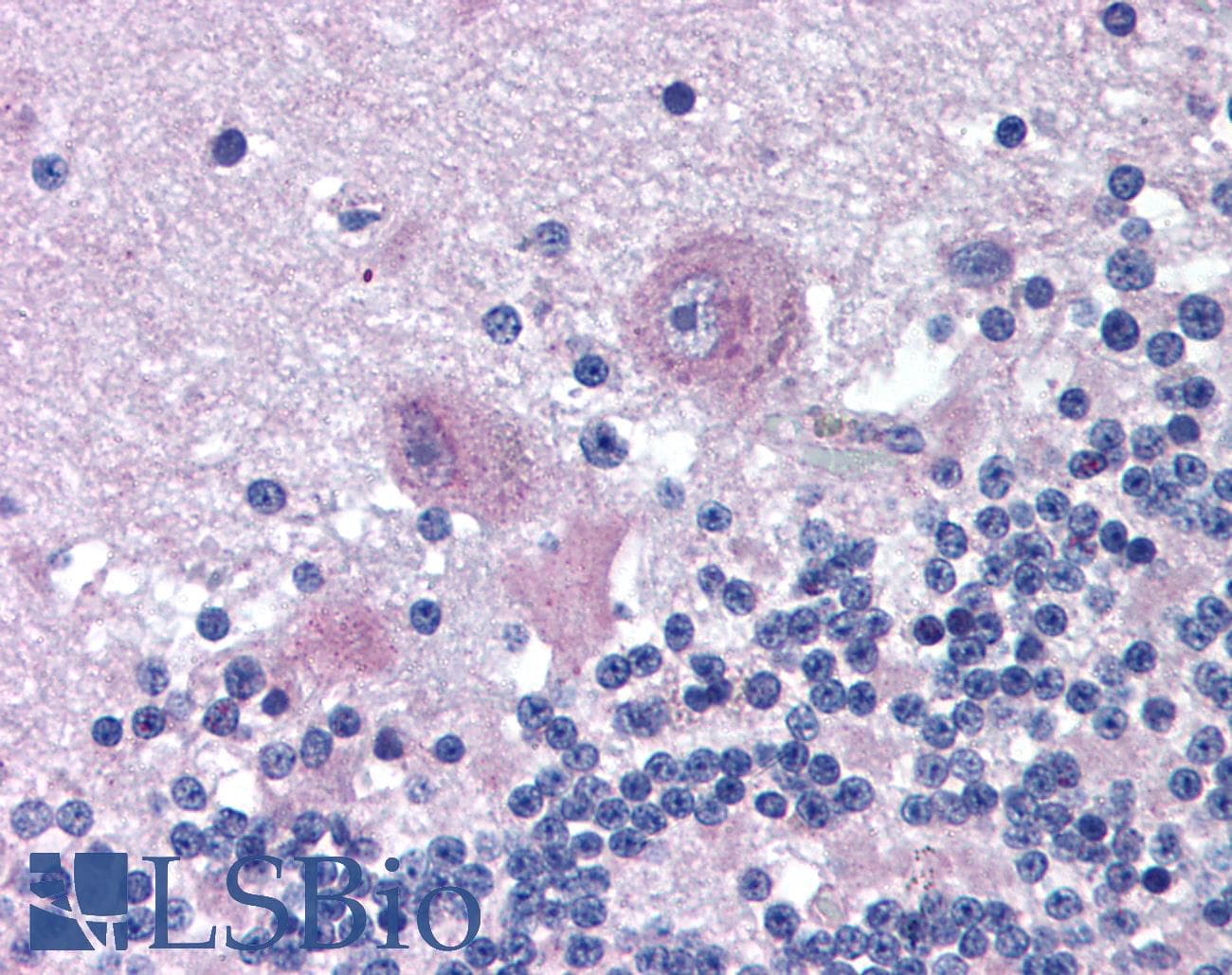 IHC-plus™ Polyclonal Goat anti-Human ARHGAP33 / SNX26 Antibody (aa1113-1126, IHC)