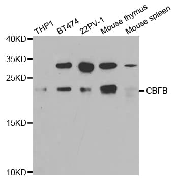 Polyclonal Rabbit anti-Human CBFB Antibody (IHC, IF, WB)