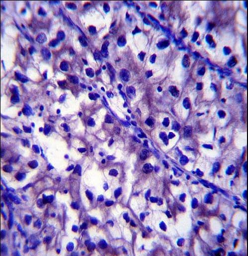 LAMB1 / Laminin Beta 1 Antibody (aa1691-1720)