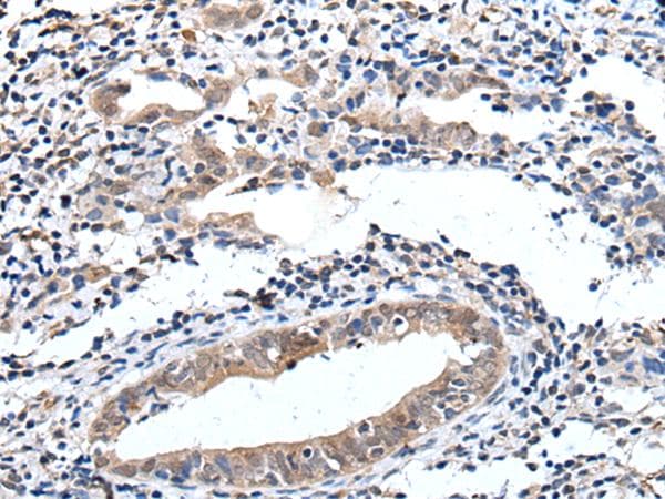 ELMO1 / ELMO 1 Antibody