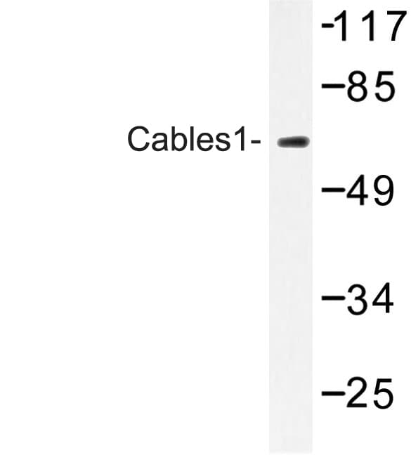 IK3-1 / CABLES1 Antibody (Lys588)