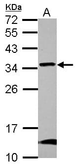 GBAS Antibody