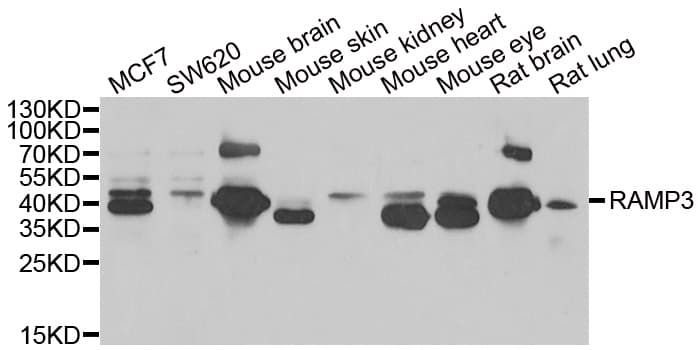 IHC-plus™ RAMP3 Antibody