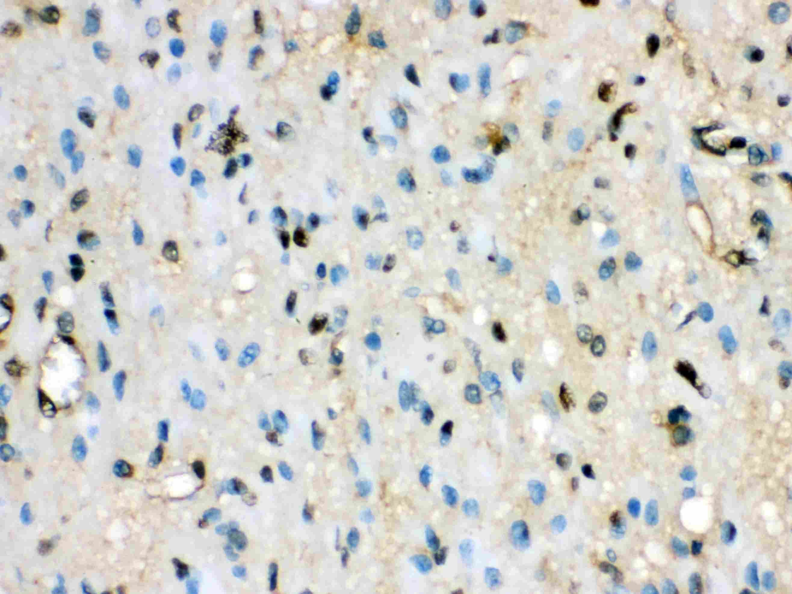 Polyclonal Rabbit anti-Human VCP Antibody (IHC, WB)