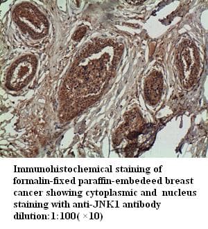 MAPK8 / JNK1 Antibody
