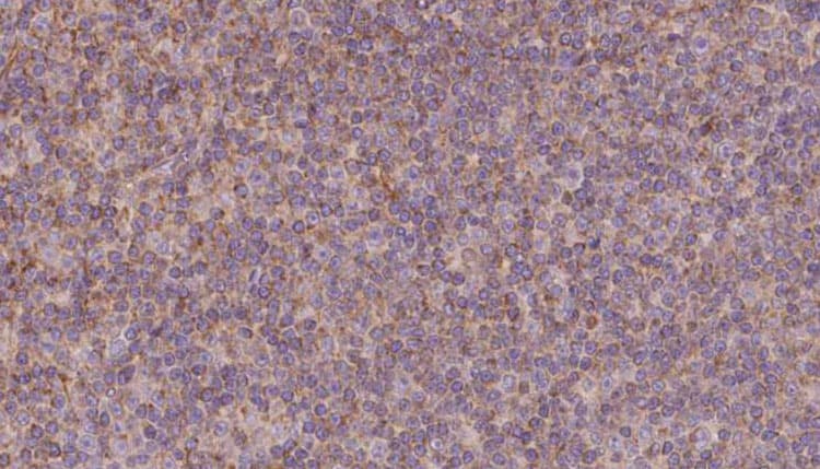 KIFC3 Antibody