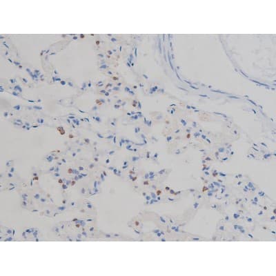 IGF1R / IGF1 Receptor Antibody (phospho-Tyr1165,pTyr1166)