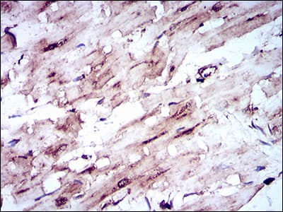 Monoclonal Mouse anti-Human SLC2A4 / GLUT-4 Antibody (clone 3G10A3, aa224-353, IHC, IF, WB)