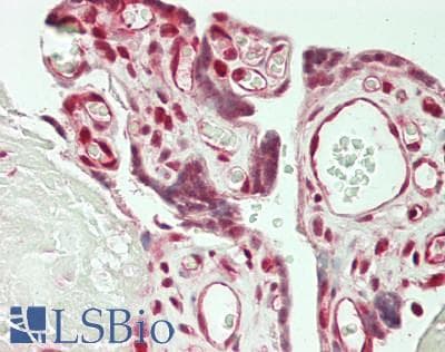 IHC-plus™ Polyclonal Rabbit anti-Human CTNNBL1 / NAP Antibody (aa1-50, IHC)