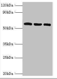 Polyclonal Rabbit anti-Human TXNRD2 Antibody (aa100-310, IHC, WB)