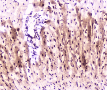 Polyclonal Rabbit anti-Mouse MEF2C Antibody (IHC, WB)