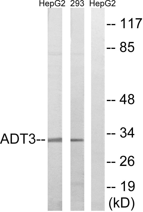 IHC-plus™ SLC25A6 / ANT3 Antibody (aa121-170)