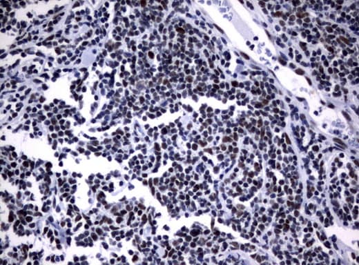 NBN / Nibrin Antibody (aa461-754, clone UMAB99)