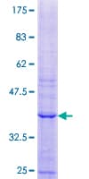 Human PREP / Prolyl Endopeptidase Protein (Recombinant GST, N-terminus)