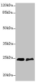 SERTAD1 / TRIP-Br1 / SEI-1 Antibody