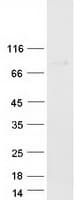 Human MX2 Protein (Recombinant Myc-DDK (Flag))