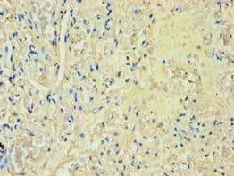 Polyclonal Rabbit anti-Human M-PST / STM Antibody (aa1-295, IHC, WB)