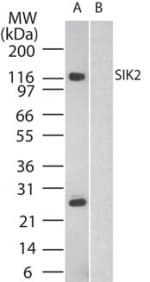 IHC-plus™ SIK2 / SNF1LK2 Antibody (aa100-150)