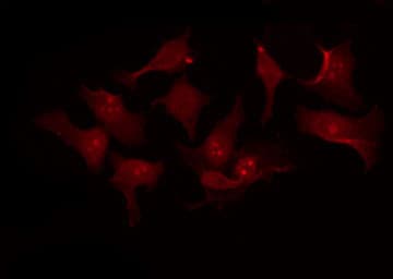 CDKN1B / p27 Kip1 Antibody (phospho-Thr198)