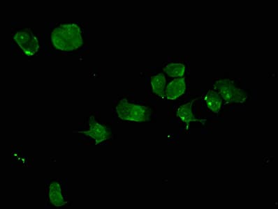 Synaptic nuclei expressed gene 2 (SYNE-2) Antibody