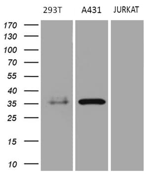 PITPNB Antibody (clone OTI5D11)