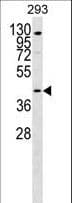 SLC52A1 / GPR172B / PAR2 Antibody (aa162-190)