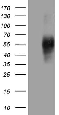 SIRPB1 / CD172b Antibody (aa30-398, clone OTI8C5, Carrier-free)