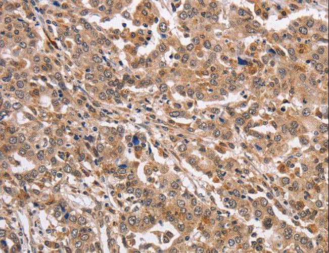 Polyclonal Rabbit anti-Human KCNG2 Antibody (IHC, WB)