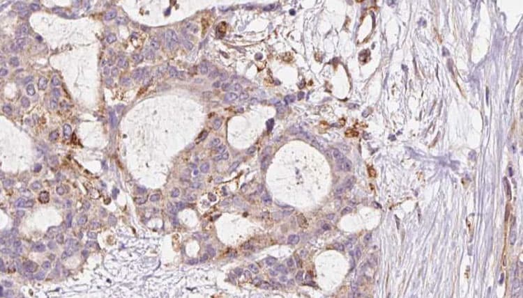 Polyclonal Rabbit anti-Human FAF2 / ETEA Antibody (IHC, WB)