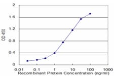 Monoclonal Mouse anti-Human HPD Antibody (clone 2F3, WB)