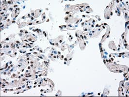 TYRO3 Antibody (clone OTI2C4)