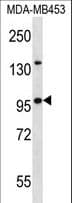 NUP88 Antibody (aa701-730)