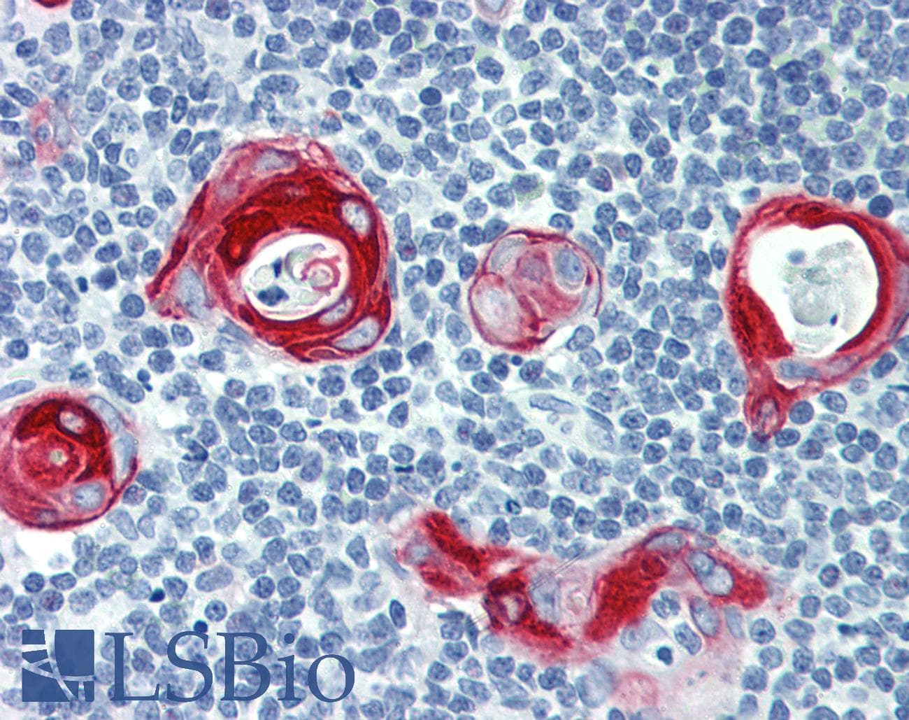 PathPlus™ Polyclonal Rabbit anti-Human KRT16 / CK16 / Cytokeratin 16 Antibody (clone R20-S, C-Terminus, IHC)