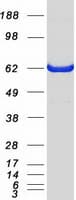 Human PRMT4 / CARM1 Protein (Recombinant Myc-DDK (Flag))