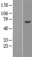Human PRAME Protein (Over-Expression Lysate Myc-DDK (Flag))