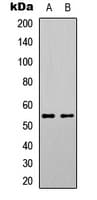 Polyclonal Rabbit anti-Human SGK1 / SGK Antibody (phospho-Ser78, WB)