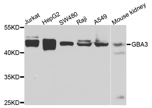 GBA3 / CBG Antibody