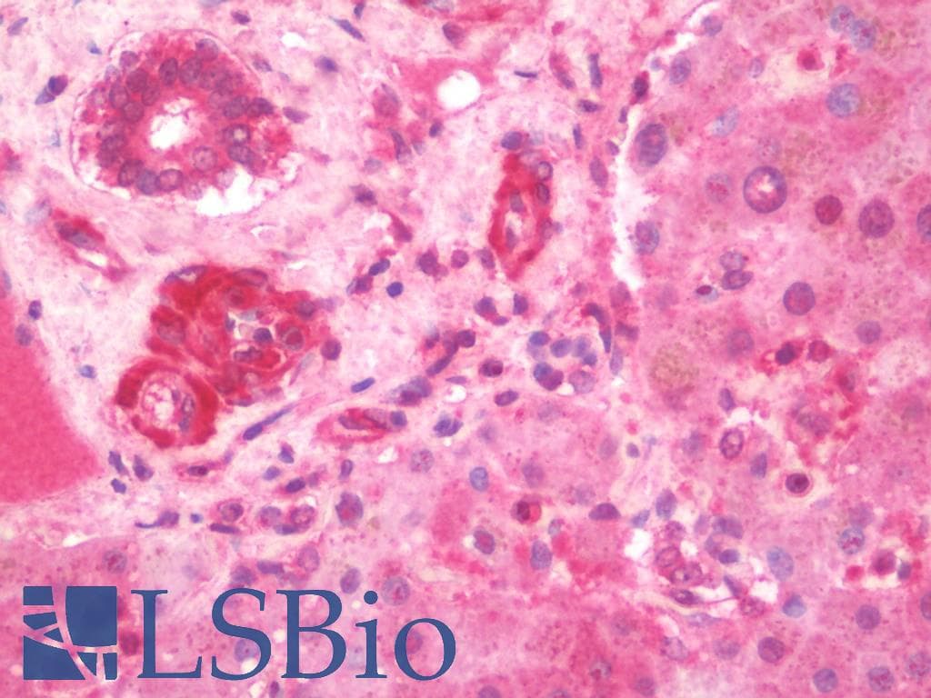 IHC-plus™ IL3RA / CD123 Antibody (aa200-305, clone 10B8E7)