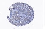 CORO1C Antibody (aa407-420)
