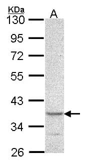 CYTIP Antibody (aa1-44)