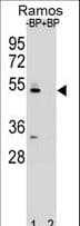 Polyclonal Rabbit anti-Human ZDHHC2 Antibody (aa77-106, IHC, WB)