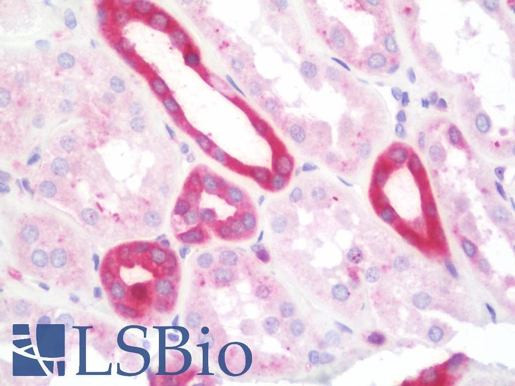 IHC-plus™ PRKCB / PKC-Beta Antibody (aa621-670)