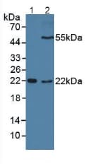 CD209 / DC-SIGN Antibody (aa70-404, Cy3)